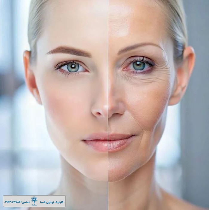 بهترین روش جوانسازی پوست