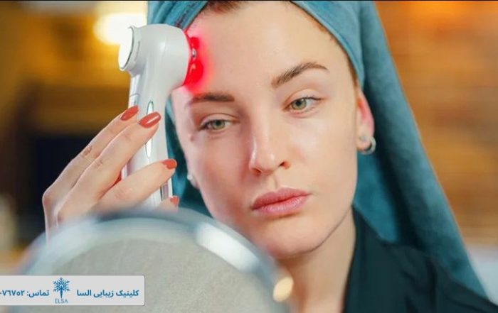 بهترین دستگاه خانگی جوانسازی پوست