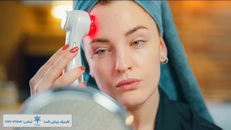 بهترین دستگاه خانگی جوانسازی پوست