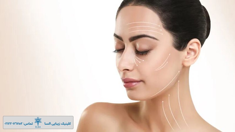 بهترین راهکارهای خانگی لیفت صورت