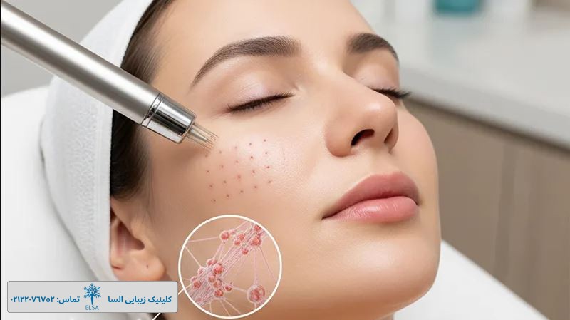 MCT بهترین روش جوانسازی صورت MCT بهترین روش جوانسازی صورت