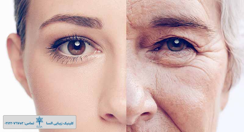 بهترین ویتامین برای کلاژن سازی پوست