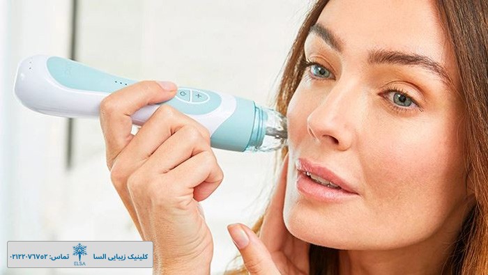 بهترین دستگاه خانگی پاکسازی پوست