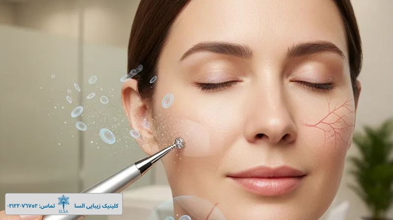 MCT بهترین روش جوانسازی صورت