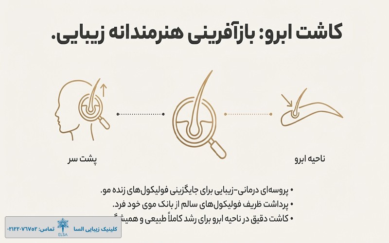مراحل کاشت ابرو