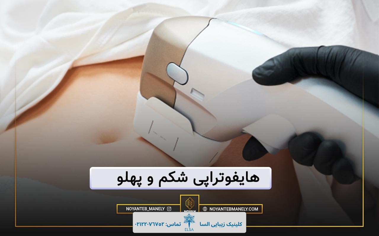 هایفوتراپی شکم چیست؟