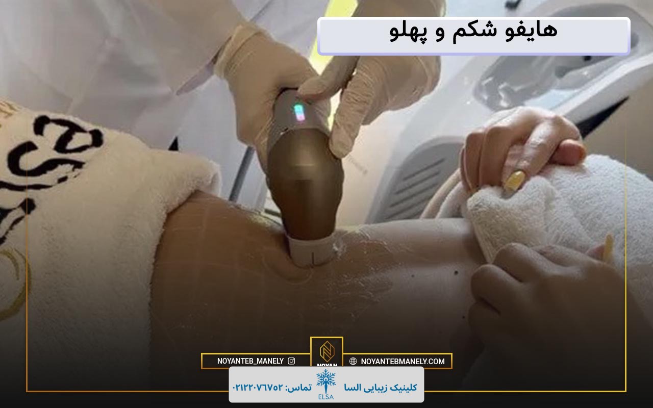 هایفو شکم و پهلو