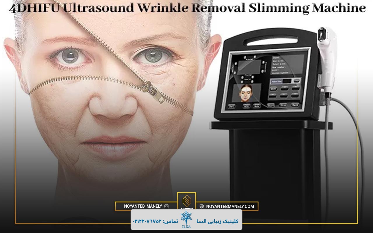 بهترین دستگاه برای هایفو صورت