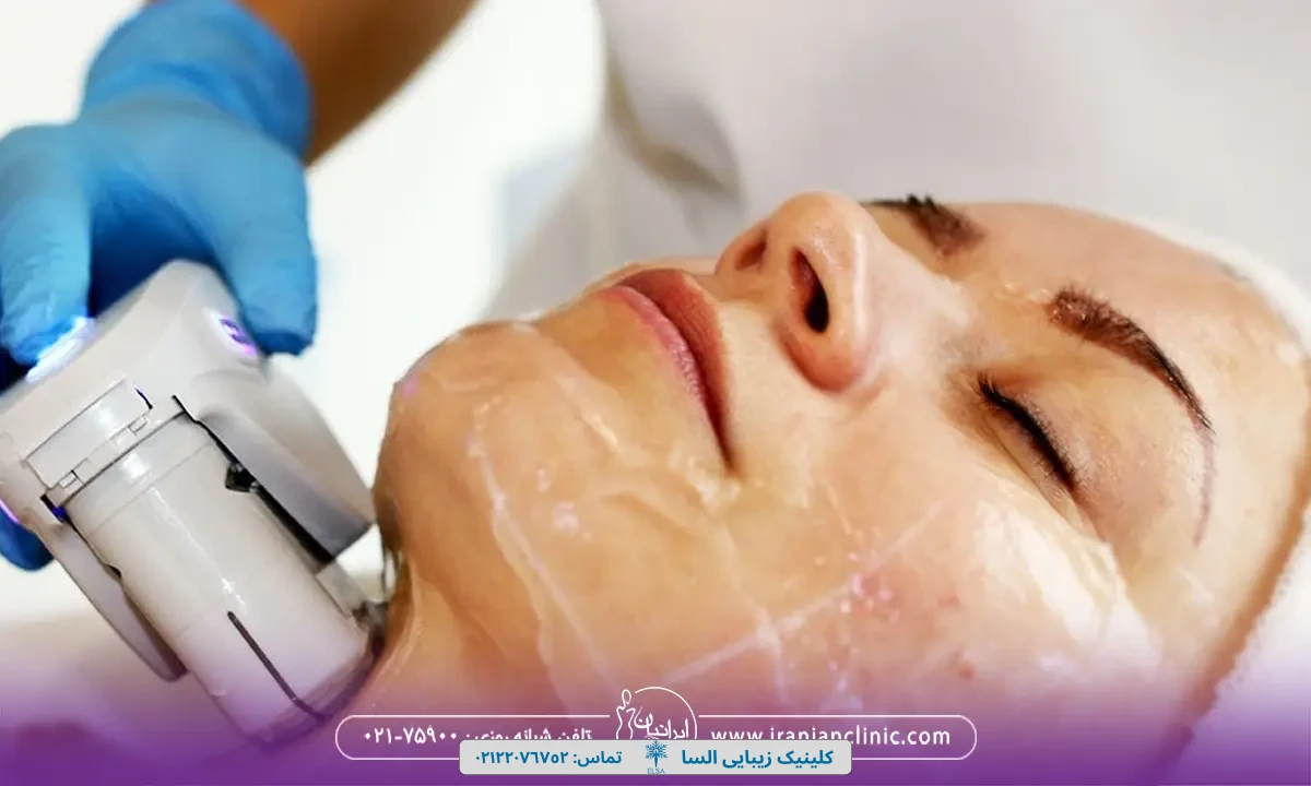 هزینه هایفوتراپی غبغب و قیمت هایفوتراپی غبغب در تهران