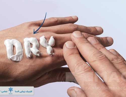 بهترین کرم برای پوست خشک دست کدام است؟