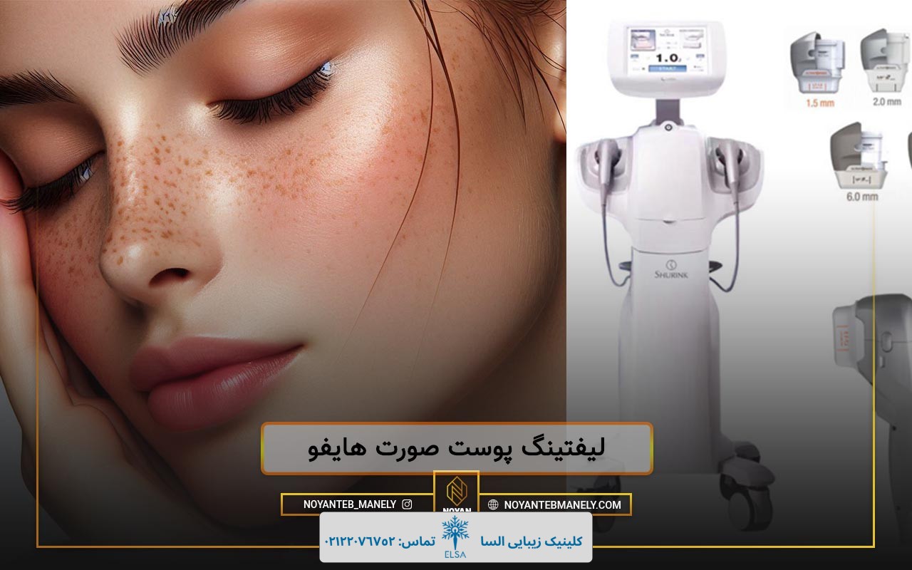 دستگاه هایفو صورت