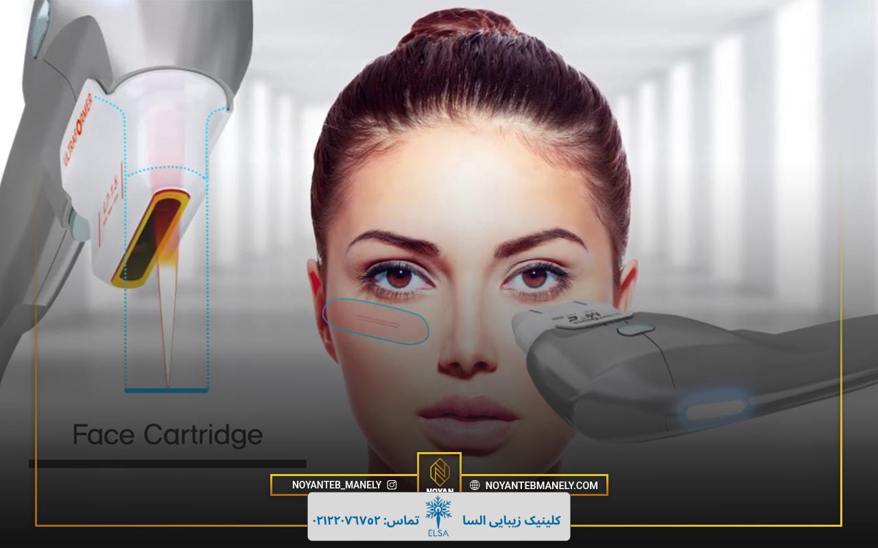 خرید دستگاه هایفو اولترافورمر 12 بعدی