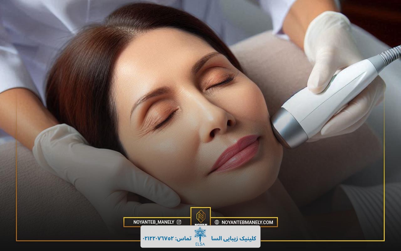 قبل و بعد از هایفوتراپی صورت