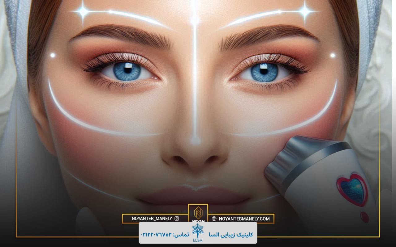 تاثیر هایفو بر صورت