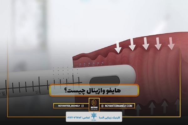 هایفو واژینال چیست؟