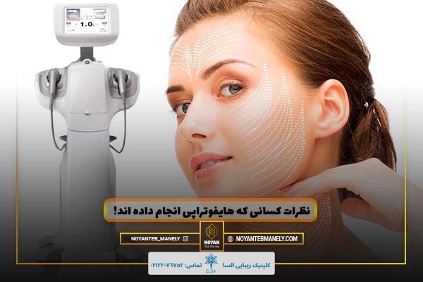 نظرات کسانی که هایفوتراپی انجام داده اند