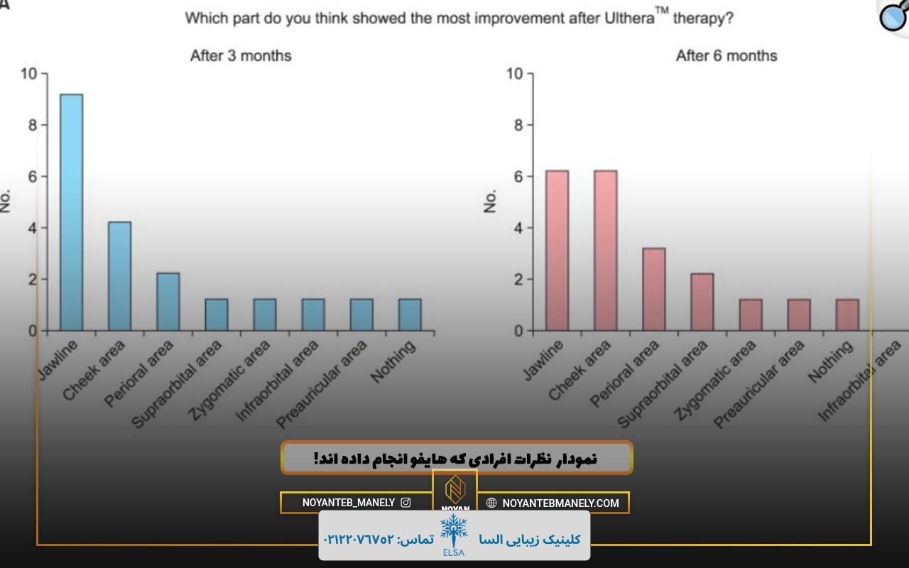 تجربیات افراد پس از هایفوتراپی