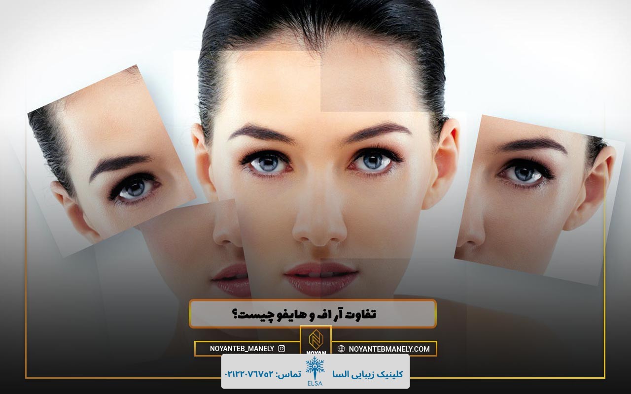 تفاوت آر اف و هایفو