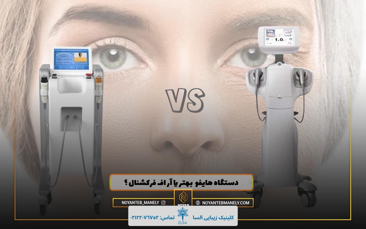 آر اف بهتر است یا هایفو نی نی سایت