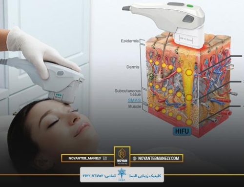 هایفوتراپی برای چه کسانی مناسب است؟