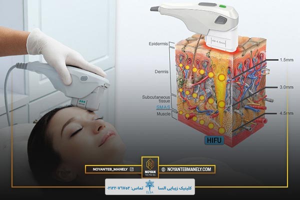 هایفوتراپی برای چه کسانی مناسب است؟